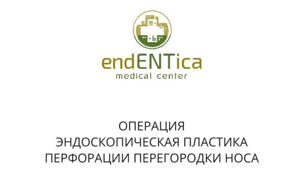 ПЕРФОРАЦИЯ ПЕРЕГОРОДКИ